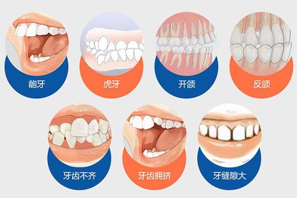 武汉合肥隐形牙齿矫正费用贵不贵?要多少钱?