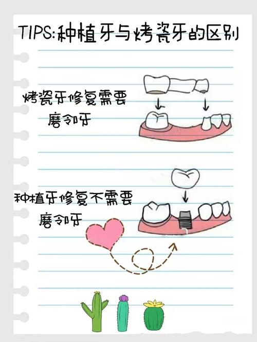 武汉假牙和种植牙有什么区别 牙医告诉你哪种更划算