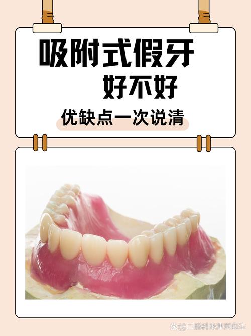 武汉缺牙不种牙?活动假牙固定桥吸附性义齿哪个好