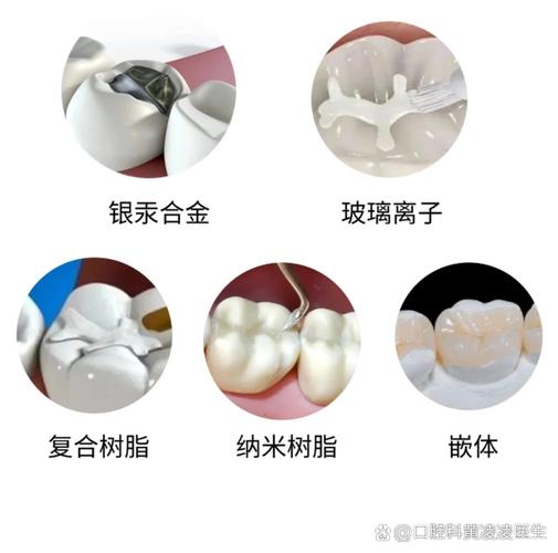 武汉补牙用什么材料好?哪种补牙材料最靠谱?