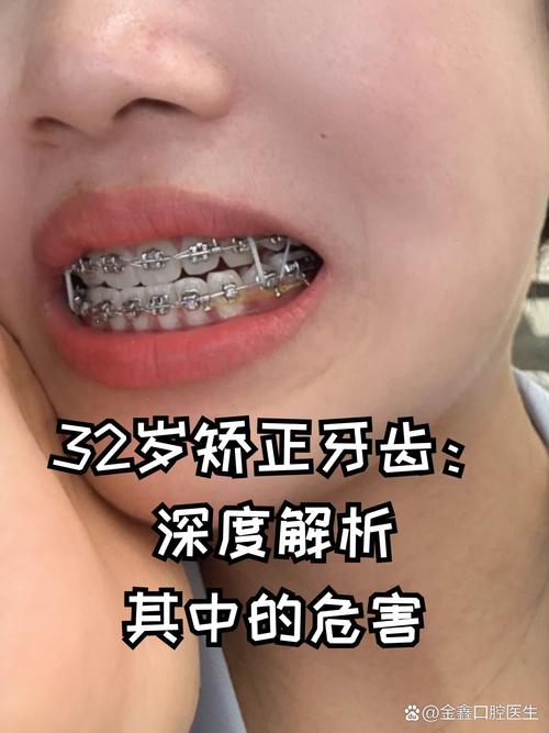 武汉39岁做牙齿矫正晚不晚?听听牙医怎么说