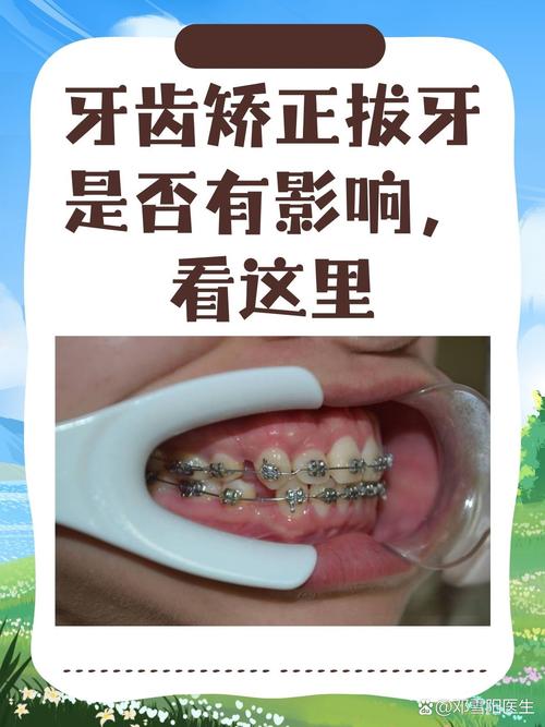 武汉哪个医院牙齿矫正比较好 教你避开这3个坑
