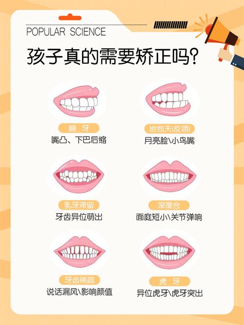 武汉宝宝地包天牙齿纠正要趁早