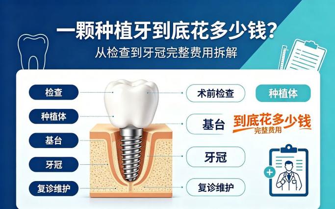 武汉广州种一颗牙到底要花多少钱?