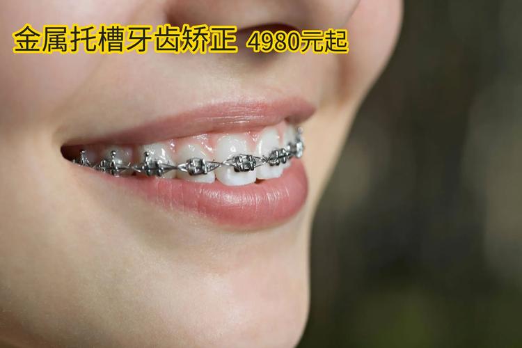 武汉38岁还能做牙齿矫正吗 大龄正畸的真相与建议