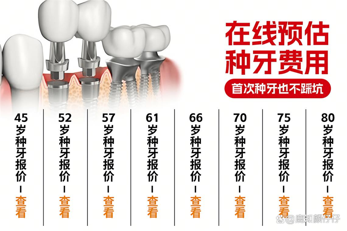 武汉深圳罗湖种牙哪家靠谱 诺贝尔种植牙医院怎么选