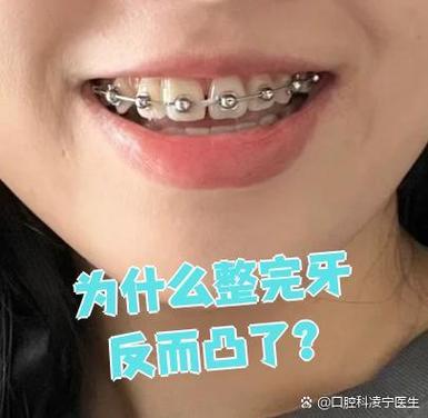 武汉牙齿不齐别担心 纠正牙齿的较佳年龄看这里