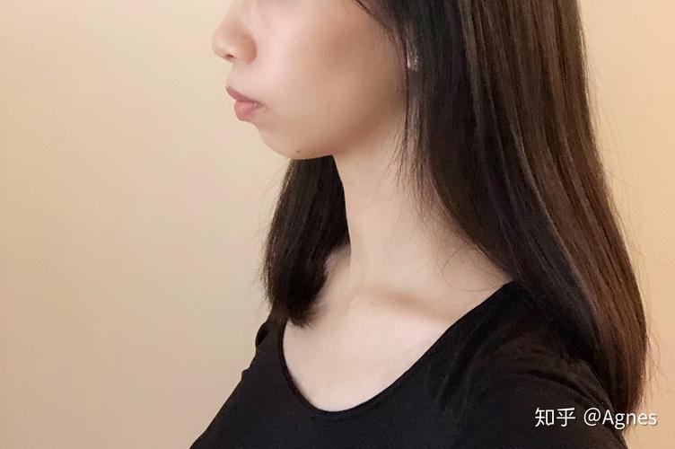 武汉深圳龙岗隐适美矫正要多久？看完这篇就清楚了