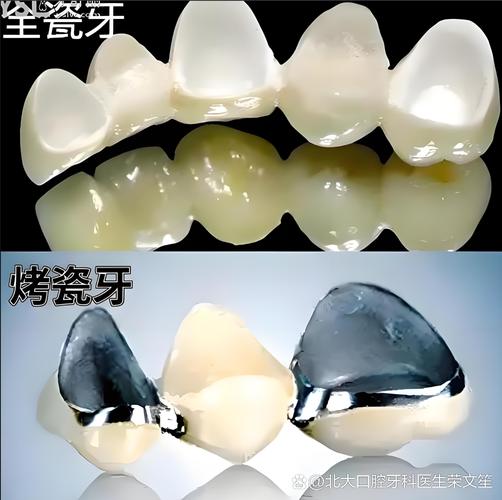 武汉天津种一颗牙要多少钱?看完这篇就懂了