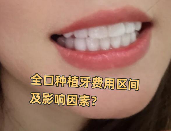 武汉深圳罗湖骨量不足全口种牙大概多少钱