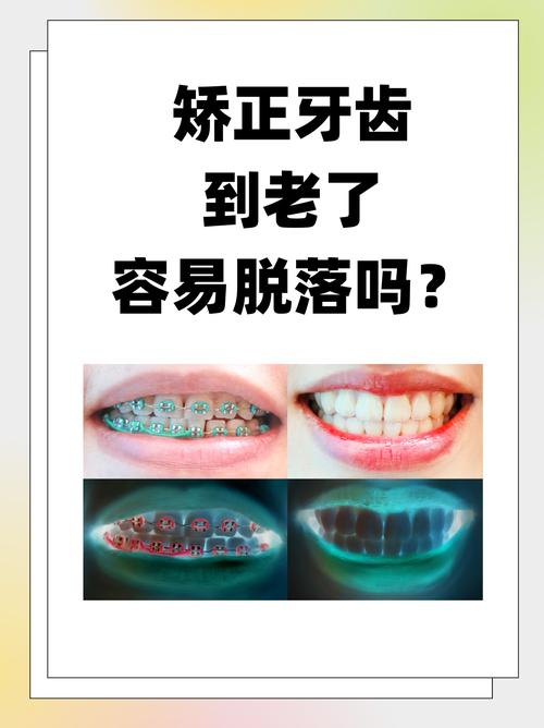 武汉43岁矫正牙齿晚不晚 过来人告诉你答案