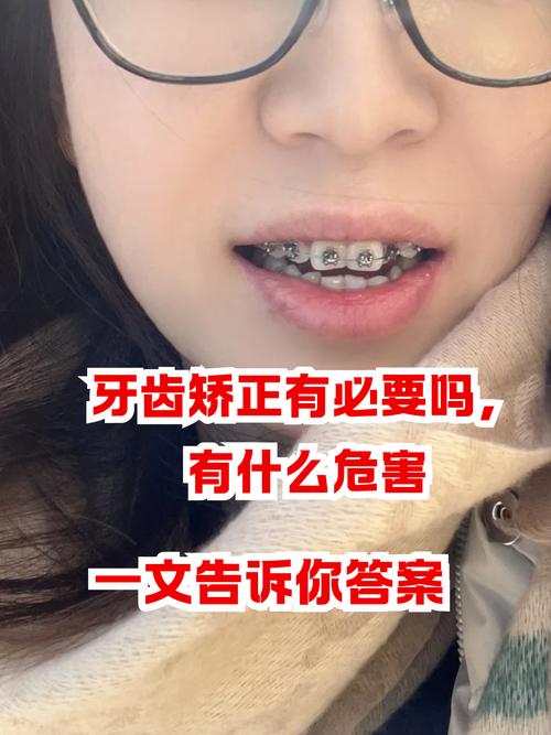 牙齿矫正晚上戴白天不戴_矫正牙齿18岁晚吗_牙齿矫正晚上戴头套