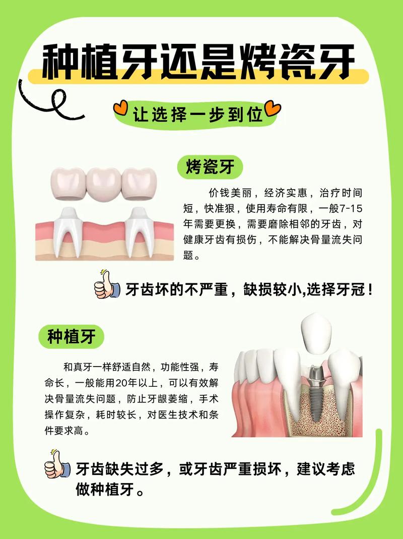 武汉烤瓷牙还是种植牙 牙医教你选对修复方式