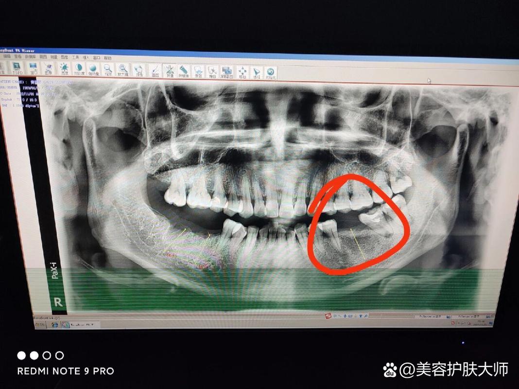 武汉深圳皓圣种植牙医院靠谱吗 真实推荐指南