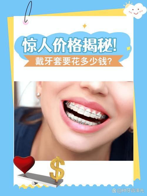 武汉矫正牙齿透明牙套到底要花多少钱 看完心里有底