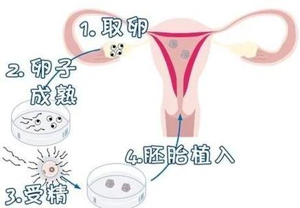 武汉第三代试管婴儿准备多少预算?这笔账你得算明白