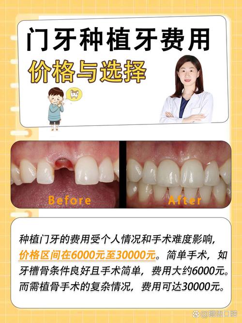 口腔种牙医院_口腔医院种牙医院_口腔牙种医院哪家好