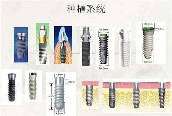 武汉种植牙国产韩系欧美价格对比，哪个品牌性价比高？