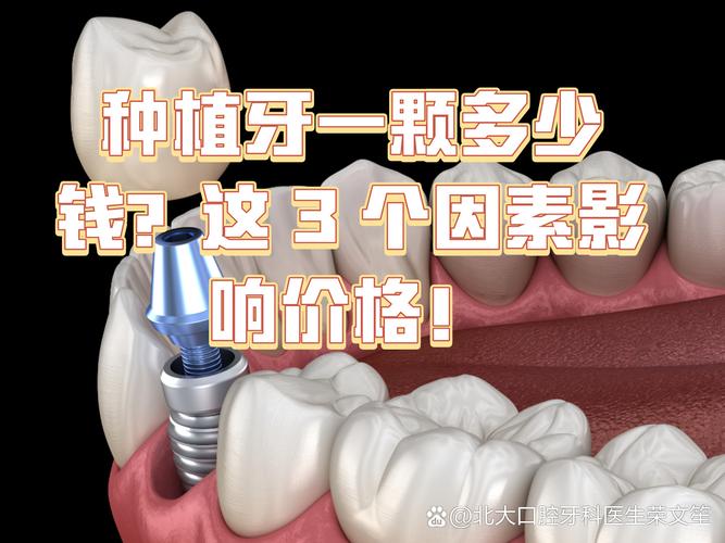 武汉镶一颗种牙要多少钱 影响种植牙费用的关键因素梳理