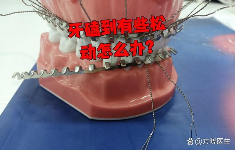 武汉孩子牙齿磕碰松动了怎么办?多久能自己长好