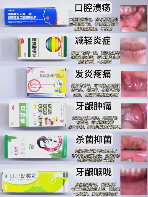 武汉小孩口腔溃疡吃什么好的快?收下这份家庭偏方与饮食指南,轻松缓解娃的疼痛