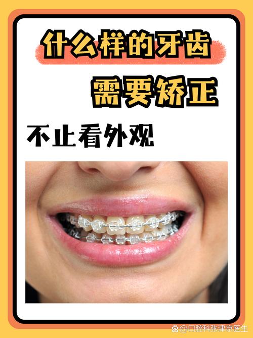 武汉45岁矫正牙齿还来得及吗?过来人分享3年真实经历,成人正畸必看