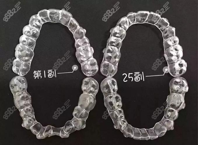 深圳隐适美隐形矫正价格明细_深圳隐适美价格_深圳隐适美矫正大概多少钱