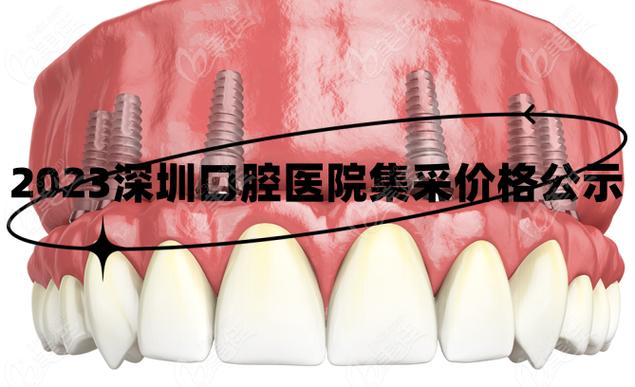 武汉深圳种牙集采落地，到底能省多少钱？
