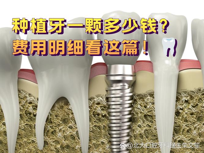 武汉西安种牙2026年最新报价:单颗2600到4900元真实情况揭秘