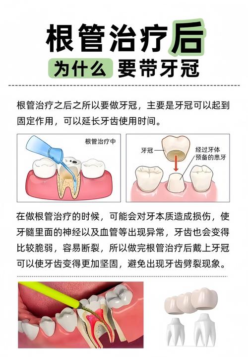 武汉根管治疗补牙到底怎么回事?医生详解步骤和必要性