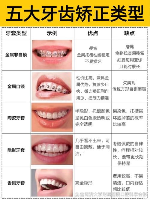 24岁想矫正牙齿晚么_牙齿矫正之后不舒服怎么办_牙齿矫正晚想要怎么办