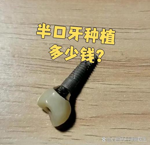 武汉深圳宝安半口种牙多少钱 中老年价格详解