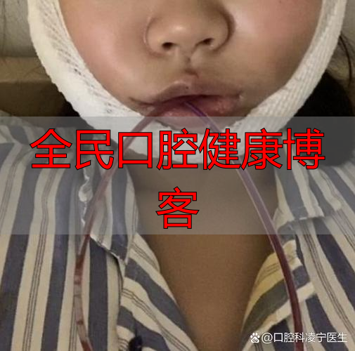 武汉口腔颌面部受伤啥特点?不只影响呼吸进食,感染风险也很高