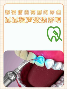 武汉自己用超声波洗牙安全吗?洗牙是医疗行为,别自己瞎搞