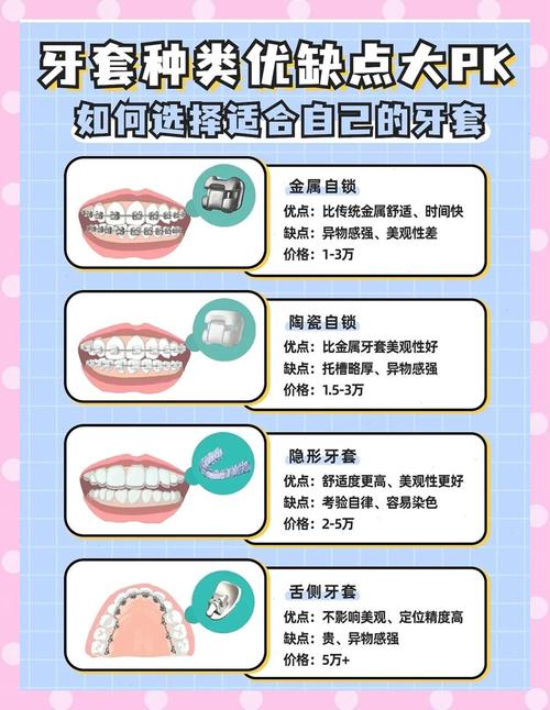 牙齿矫正适合什么牙齿情况_25岁还适不适合牙齿的矫正_牙齿矫正适用人群
