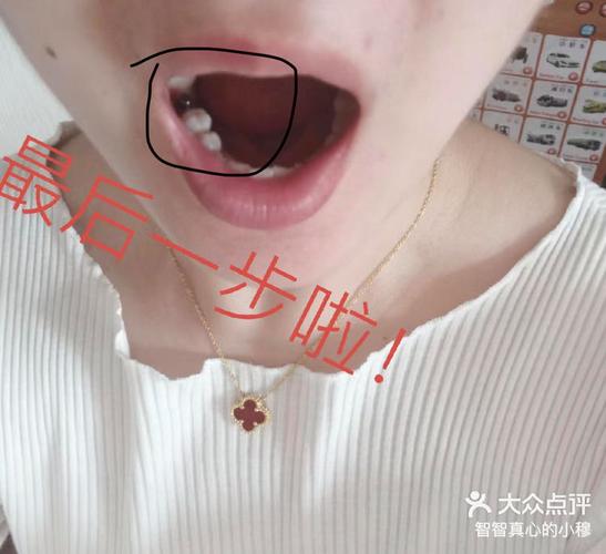 武汉宝安新安种植牙哪家医院好？真实体验告诉你