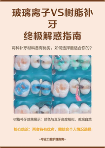 武汉补牙材料有哪几种?牙医详解复合树脂和玻璃离子的优缺点