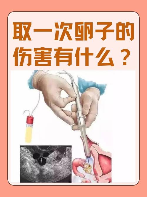 武汉取卵麻醉到底疼不疼 会不会影响卵子质量 医生一次说清