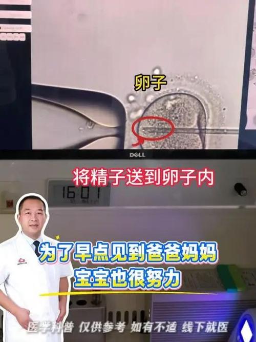 武汉二代试管原理详解 卵胞浆内单精子注射如何助孕