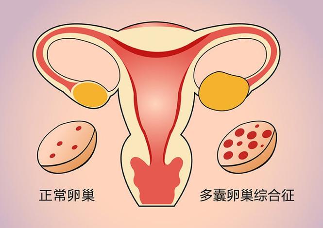 武汉HIV治疗后到底能不能生孩子?感染者生育指南