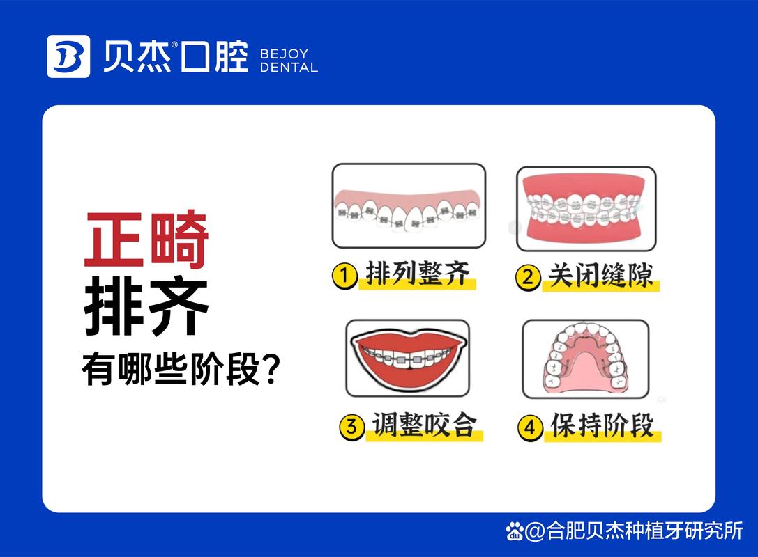 武汉儿童牙齿排列不齐去哪家医院矫正效果最好?