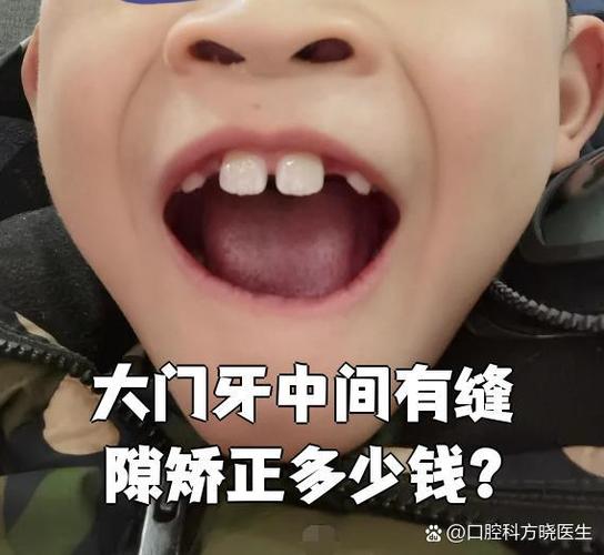 武汉矫正牙齿到底要花多少钱?2026年最新价格大揭秘