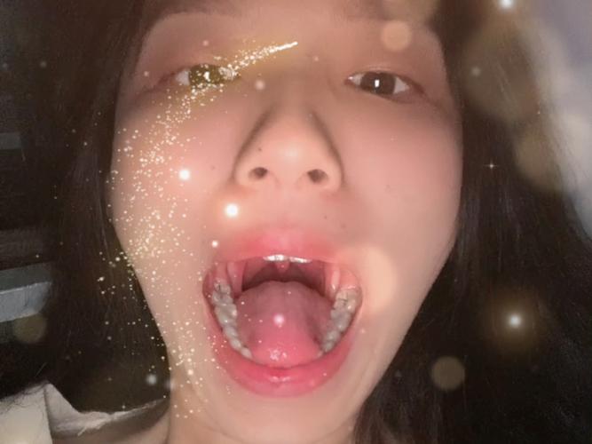 武汉口腔检查第一视角真的有用吗？