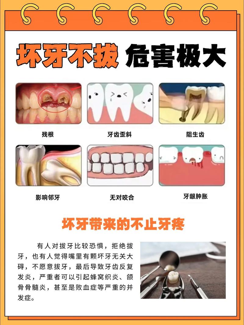 武汉大牙拔掉后不种植 小心这些后果