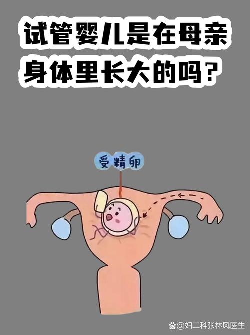 武汉试管婴儿常见误区有哪些 专家一次说清