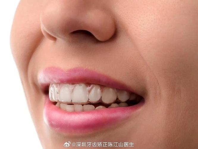 武汉成年人矫正牙齿多久能好?揭秘快速整牙的真相与代价