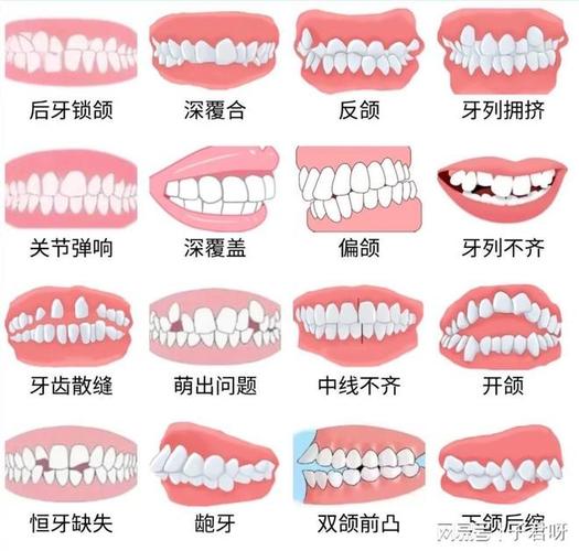 武汉儿童牙齿矫正一般价格多少？带娃整牙到底花几万
