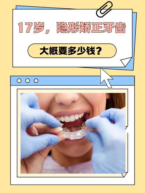 武汉德韩隐形矫正牙齿效果好吗 价格多少