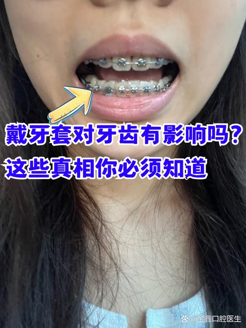 武汉成人矫正牙齿口腔值得做吗 这些真相医生不会主动说