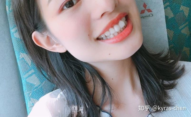 武汉成人门牙不齐矫正真的很简单吗